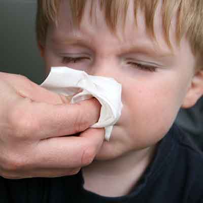 Child with a nose-bleed.